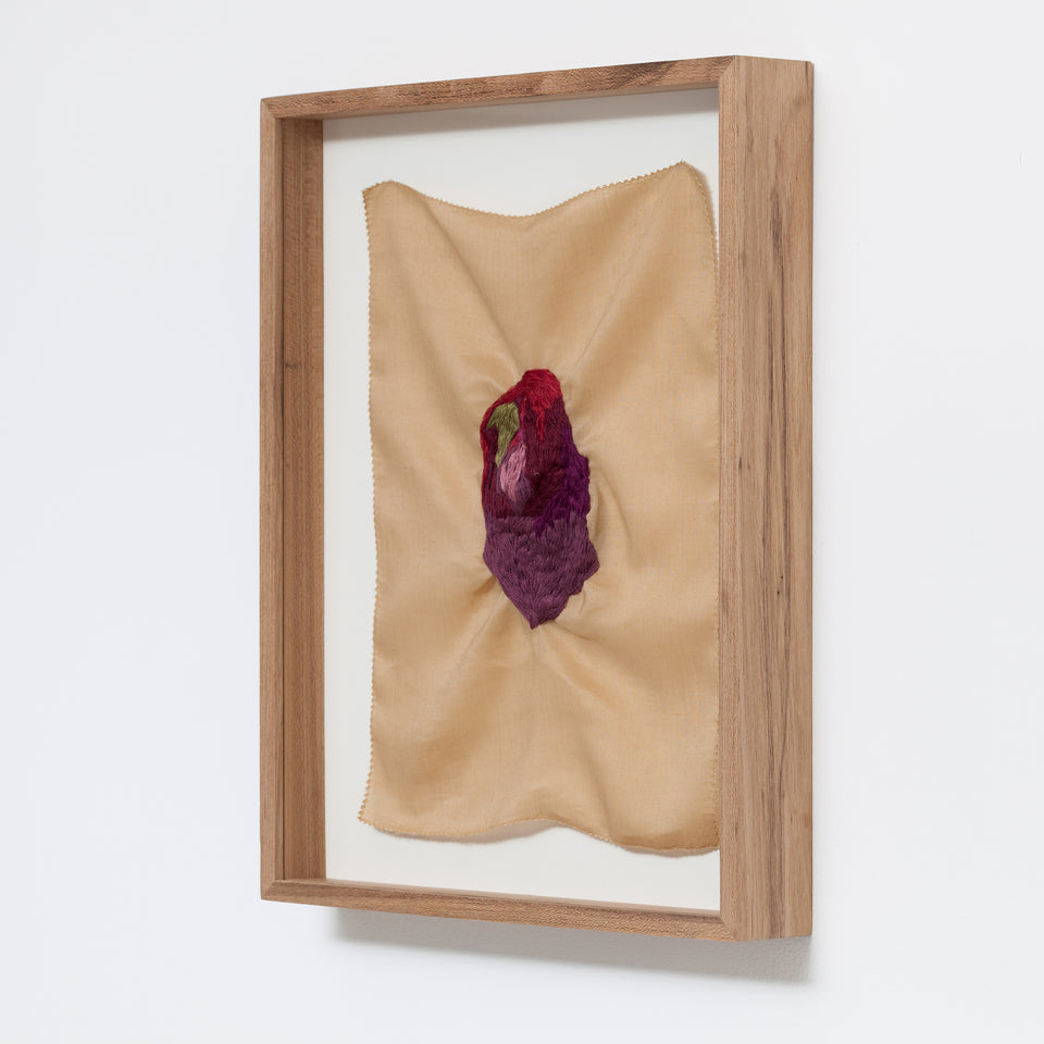 Brígida Baltar, O hematoma  #1