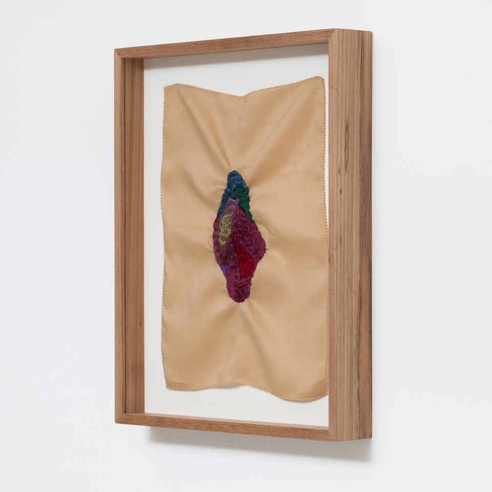 Brígida Baltar, O hematoma  #2